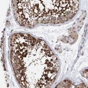 Anti-CETN1 antibody produced in rabbit 