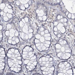 Anti-CETN1 antibody produced in rabbit 