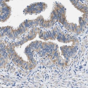 Anti-CFAP20 antibody produced in rabbit 