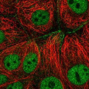 Anti-CFAP206 antibody produced in rabbit 