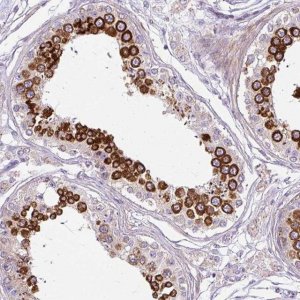 Anti-CFAP47 antibody produced in rabbit 
