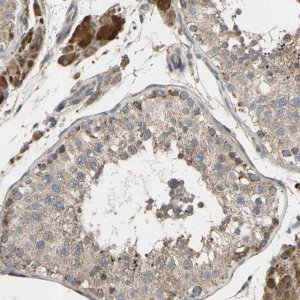 Anti-CFAP61 antibody produced in rabbit 