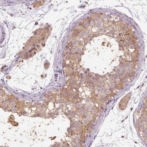 Anti-CFAP65 antibody produced in rabbit 