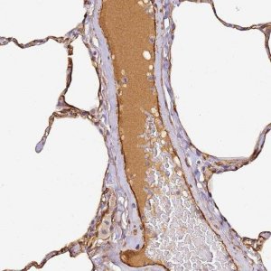 Anti-CFHR1 antibody produced in rabbit HPA038922-100UL