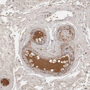 Anti-CFI antibody produced in rabbit HPA024061-100UL