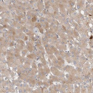 Anti-CFI antibody produced in rabbit HPA024061-100UL