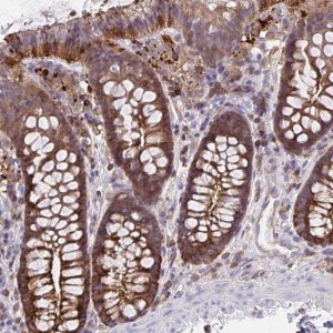 Anti-CFL1 antibody produced in rabbit 