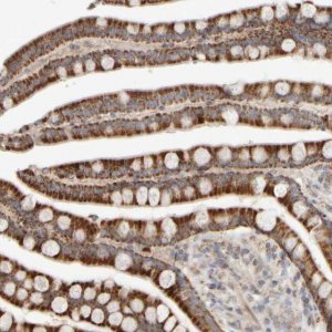 Anti-CHADL antibody produced in rabbit 
