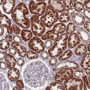 Anti-CHCHD6 antibody produced in rabbit 