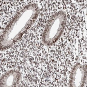 Anti-CHD4 antibody produced in rabbit 