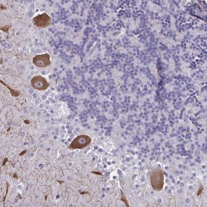Anti-CHD5 antibody produced in rabbit 