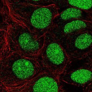 Anti-CHD7 antibody produced in rabbit 