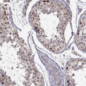 Anti-CHFR antibody produced in rabbit 