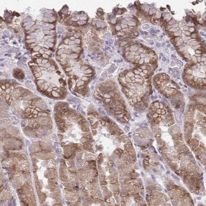 Anti-CHIA antibody produced in rabbit 