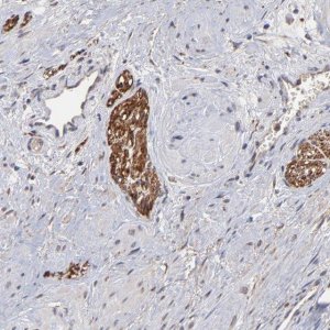 Anti-CHL1 antibody produced in rabbit 