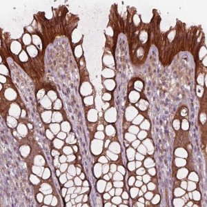 Anti-CHMP3 antibody produced in rabbit 