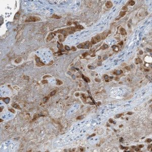 Anti-CHPF2 antibody produced in rabbit 