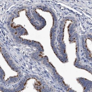 Anti-CHRNA3 antibody produced in rabbit 