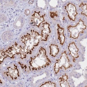 Anti-CHSY1 antibody produced in rabbit 