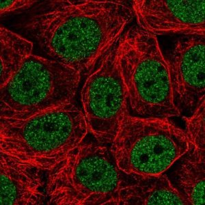 Anti-CHTF18 antibody produced in rabbit 