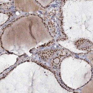 Anti-CIB4 antibody produced in rabbit 