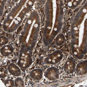Anti-CIDEC antibody produced in rabbit 