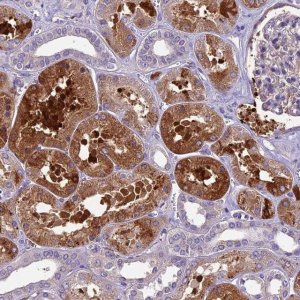 Anti-CILP2 antibody produced in rabbit 