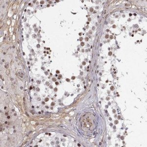Anti-CIR1 antibody produced in rabbit 