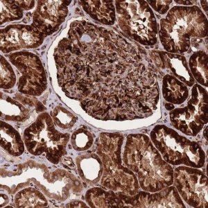 Anti-CISH antibody produced in rabbit 