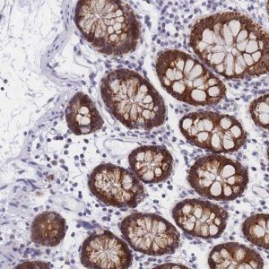 Anti-CKMT1A antibody produced in rabbit 