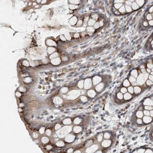Anti-CLCN2 antibody produced in rabbit 