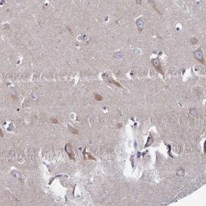 Anti-CLCN3 antibody produced in rabbit 