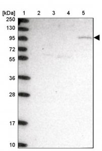 Anti-CLCN3 antibody produced in rabbit 