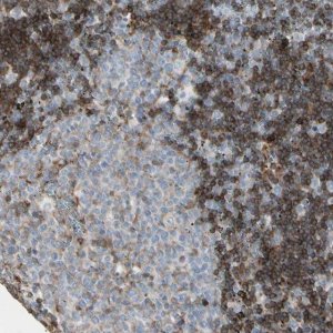 Anti-CLEC2B antibody produced in rabbit 