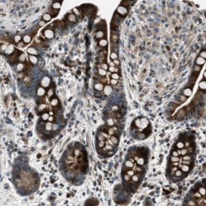 Anti-CLEC2D antibody produced in rabbit 