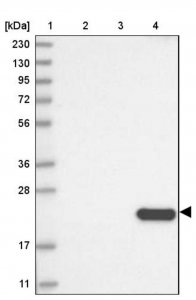 Anti-CLEC3B antibody produced in rabbit 