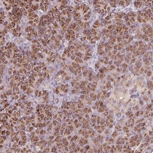 Anti-CLIC6 antibody produced in rabbit 