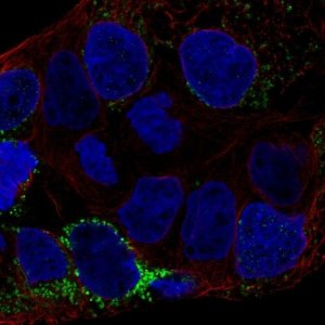 Anti-CLN6 antibody produced in rabbit 