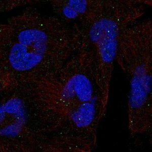 Anti-CLTCL1 antibody produced in rabbit 