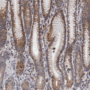 Anti-CMPK2 antibody produced in rabbit 