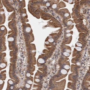Anti-CMPK2 antibody produced in rabbit 
