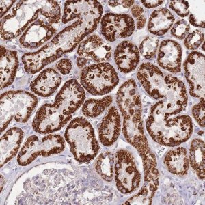Anti-CNOT8 antibody produced in rabbit 