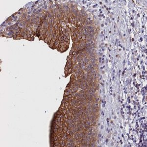 Anti-COL19A1 antibody produced in rabbit 