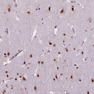 Anti-COL23A1 antibody produced in rabbit 