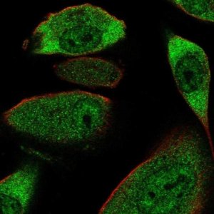 Anti-COL28A1 antibody produced in rabbit 