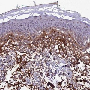 Anti-COL6A6 antibody produced in rabbit 