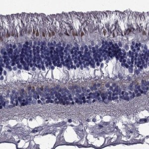Anti-COL9A1 antibody produced in rabbit 