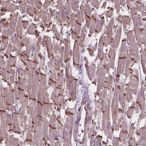Anti-COMMD4 antibody produced in rabbit 