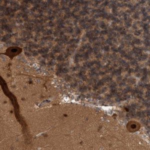 Anti-COPS3 antibody produced in rabbit HPA021997-100UL