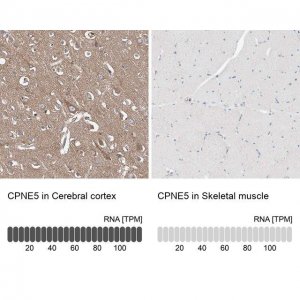 Anti-CPNE5 antibody produced in rabbit 